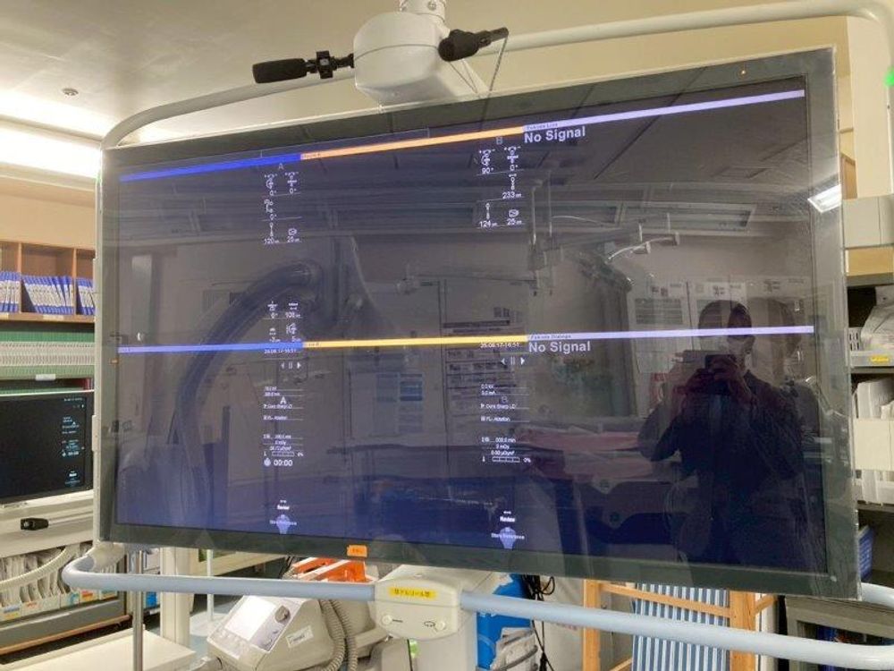 Siemens Artis Zee BC Twin Monitor Displaying No Signal