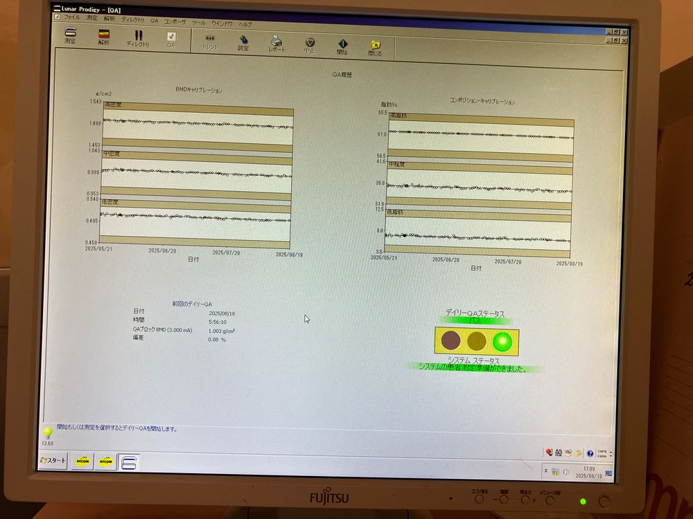GE Lunar Prodigy Dexa QA Interface