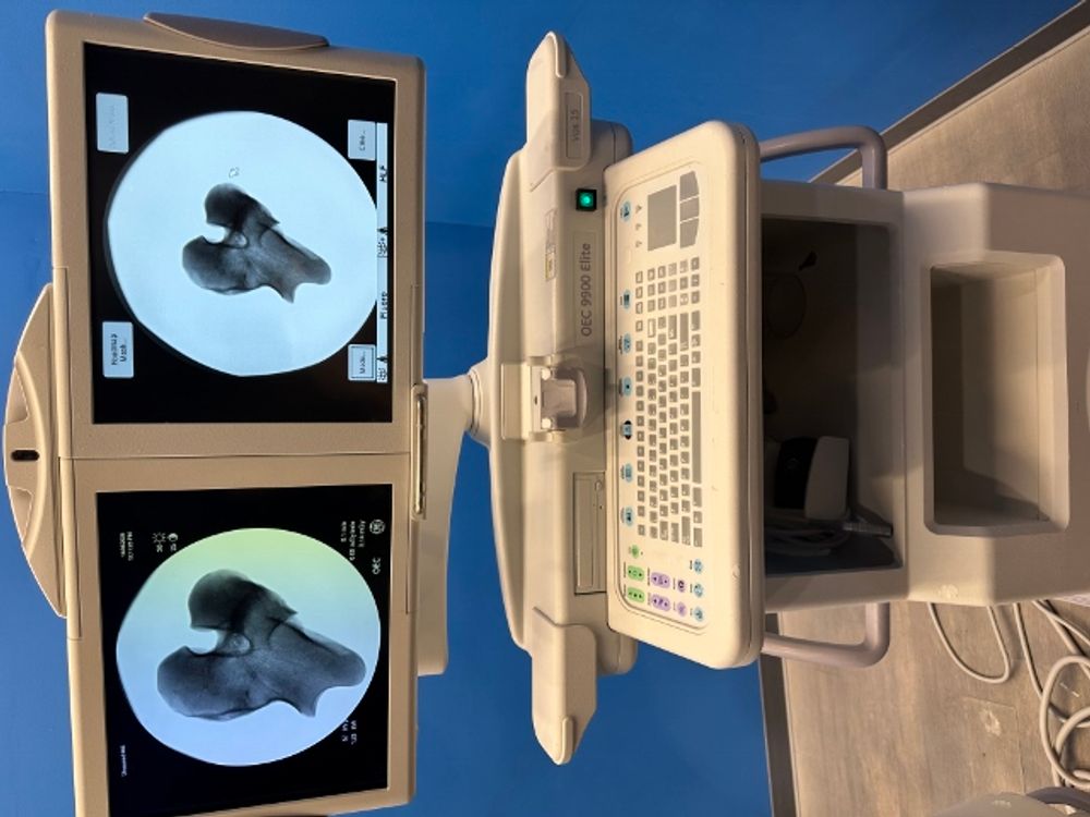 X-Ray of hip on OEC 9900 Elite Vascular C-Arm