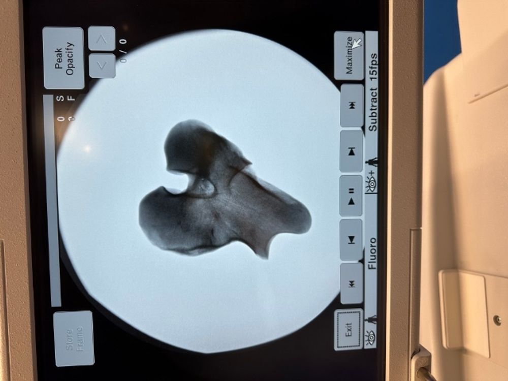 X-ray Image of Hip Joint on OEC 9900 C-Arm