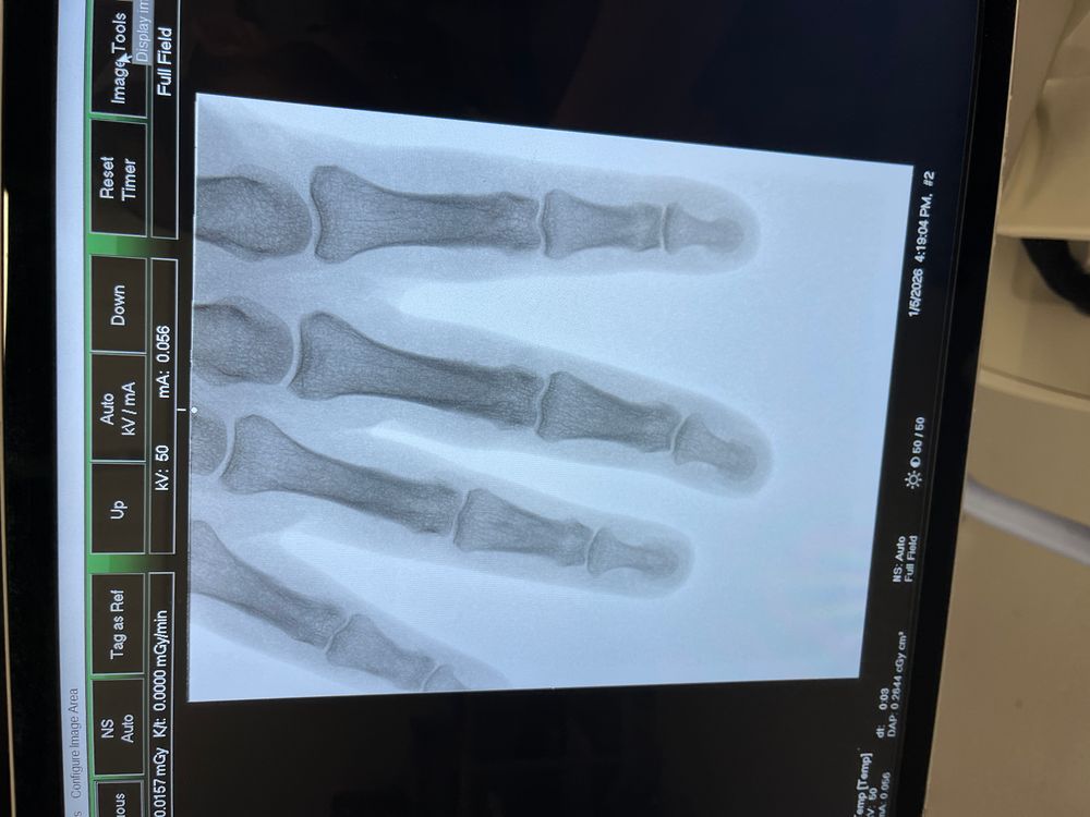 Hand X-Ray