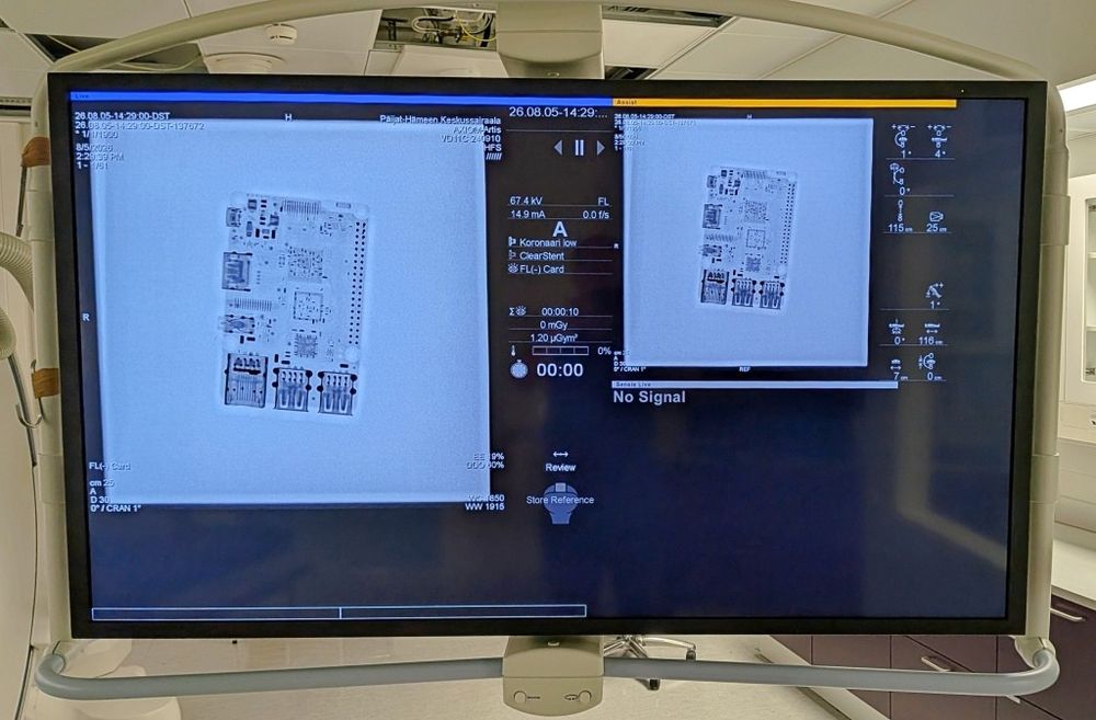 X-ray of Electronic Card on Siemens Artis Zee Monitor