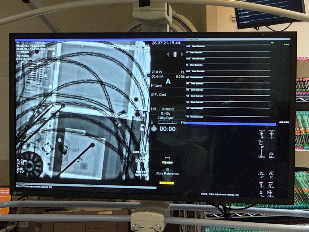 Siemens AXIOM Artis Fluoroscopy Display with Wires at University of Miami Hospital 2021-07-26