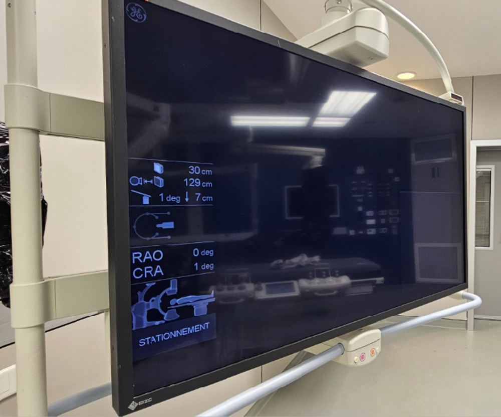 GE Discovery IGS 730 Display