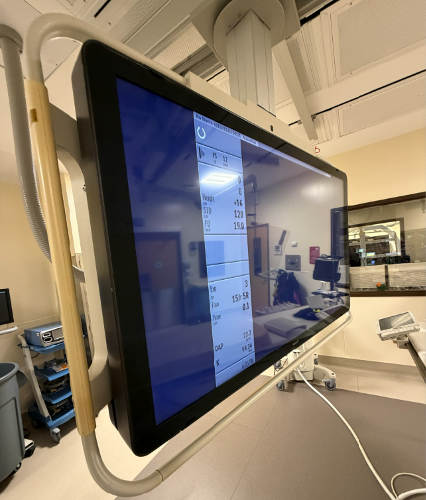 Philips Allura XPER FD 20 Monitor Displaying Imaging Parameters