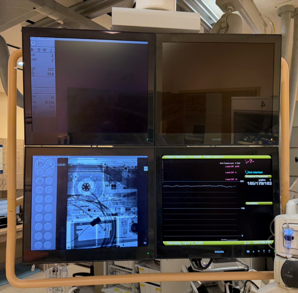 Philips Allura XPER FD20 Monitor Display